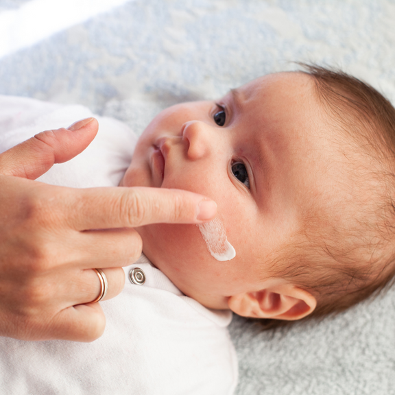Eczema in Children: 14 Survival Tips For Caring For Your Child With Eczema