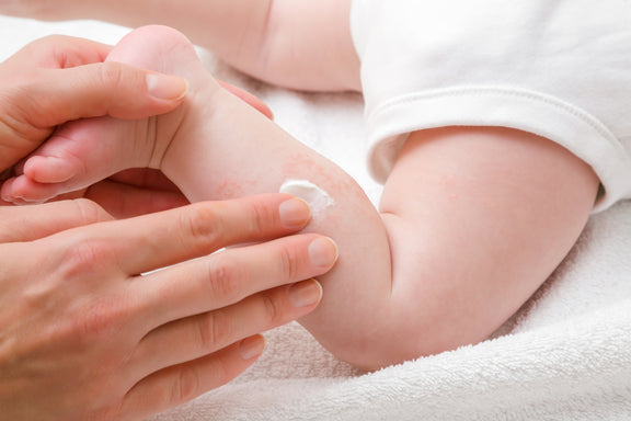 8 Best Moisturizer Ingredients for Soothing Eczema in Babies (Plus, Top Ingredients to Avoid!)