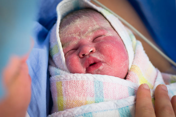 What is Vernix Caseosa? How Long To Leave It On Baby?