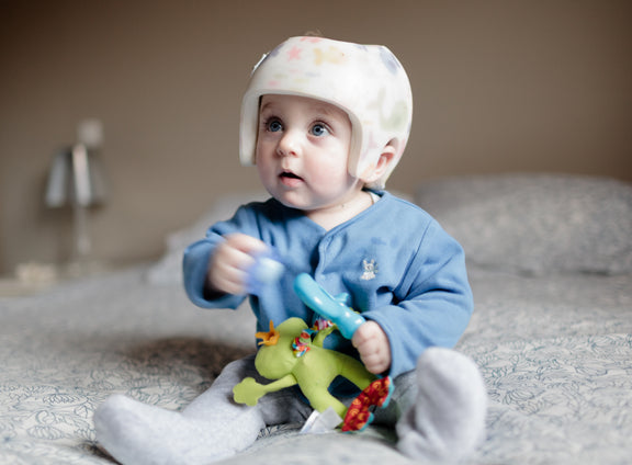 What Is Flat Head Syndrome (Plagiocephaly Or Brachycephaly)?