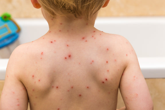 Does My Baby Have a Viral Rash? Symptoms and Tips For Relief